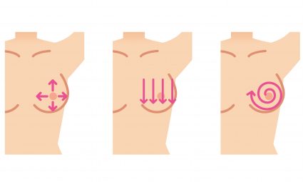 Scheme on how to check out your breast to find breast cancer